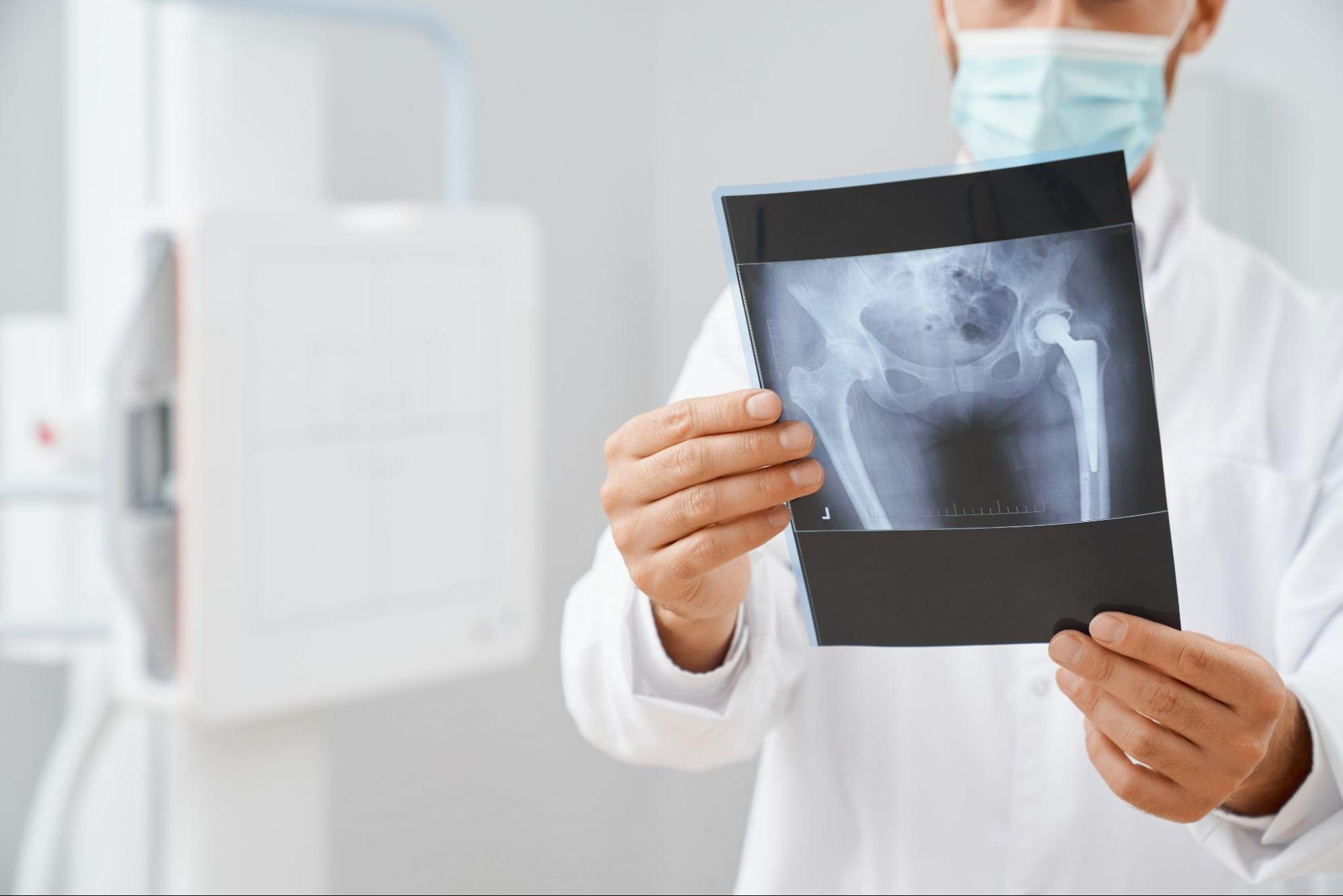 Bone Cancer: Bone Ache. When Should I Be Worried and Get It Checked?