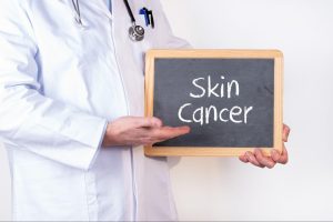 hidden-signs-of-skin-cancer-you-might-miss-300x200
